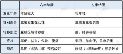 右半结肠癌|左半结肠癌 vs.右半结肠癌，这 4 大差异，你能答全吗？