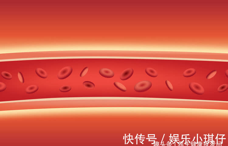 指南|醋是血管清道夫，促消化还是软化血管？提醒：4种食物，最毁血管