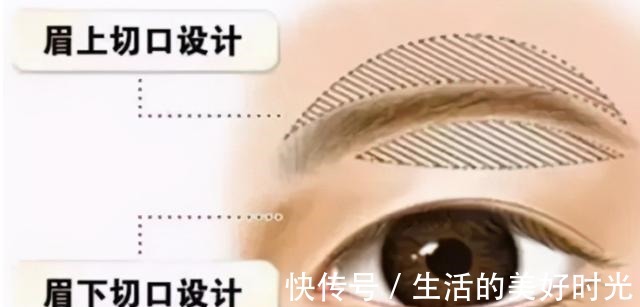 眼皮 提眉手术,求美者关心的问题!