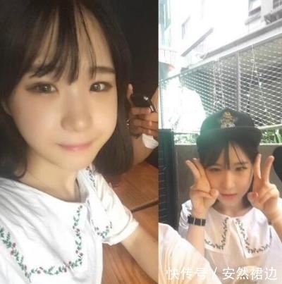 小脸确实更可爱,看完整容过程,只觉得满屏的疼痛