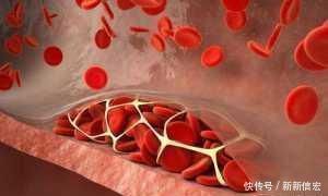 降脂|转告家人:1果是降脂“高手”,经常吃,打扫血管,降甘油三酯