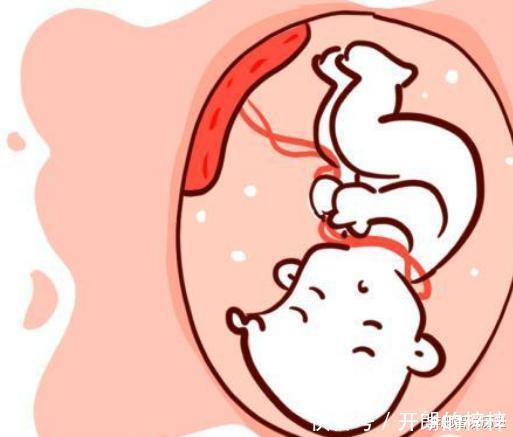 畸形|孕妈这个月份容易导致胎儿畸形，熬过去了宝宝才安全，孕妈需注意