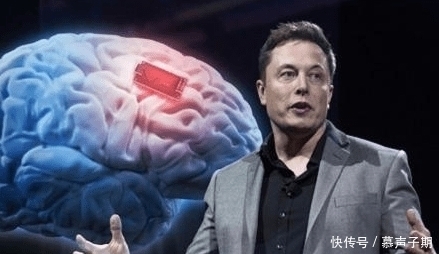 link 比马斯克靠谱!中国前首富投资10亿,脑机研究成果公布