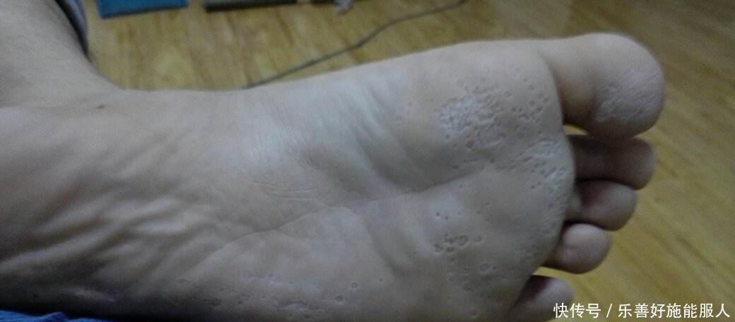 “肝”好不好看脚，脚上若没有这几点变化，说明肝还很健康！
