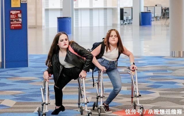 双胞胎姐妹|美国连体双胞胎姐妹共用下肢,怀孕了怎么办?