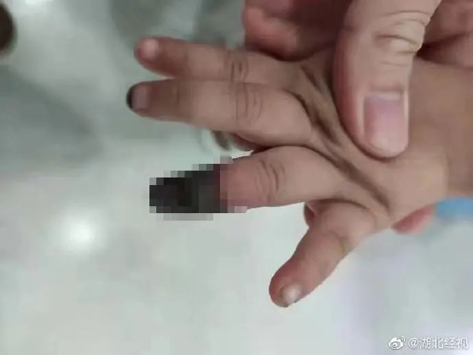 鸽子粪|吞蝌蚪、喝蟑螂水、吃鸽子粪……你被“偏方秘方”坑过吗？