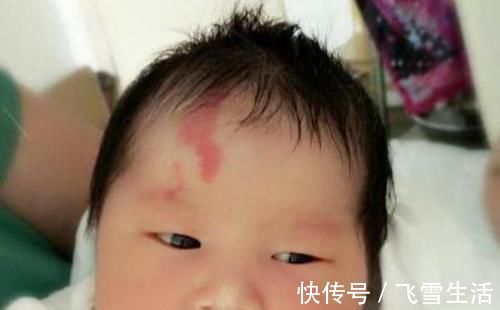 胎儿|胎记是怎么来的产科医生孕期远离3种行为,避免胎儿长记号