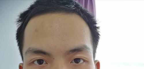  有没有|“眉毛一根长，能抵万担粮”，有没有科学依据？3个常识需要了解