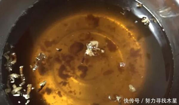 夫妻双双得胃癌，医生感叹天天刷锅，却忘了做一件事