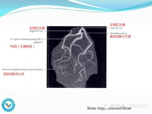 mr|椎-基底动脉系统解剖