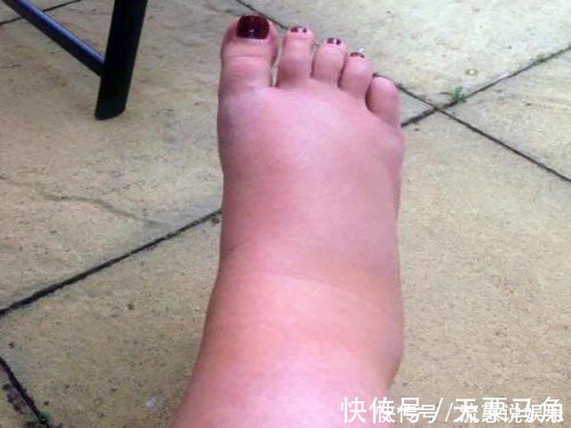 顺产|孕妇顺产7小时,自己却永远成了残疾人,分娩时这玩意要摘下来