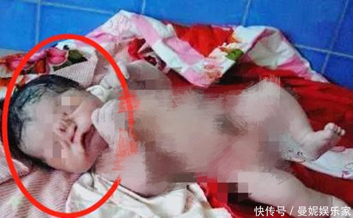 高龄产妇生下“猪八戒”宝宝,丈夫不想抚养,医生的解释挽救了娃