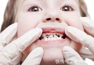 牙釉质|别等牙疼才后悔!如何保护牙齿,你必须得知道