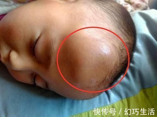 妈妈|1岁宝宝摔下床,妈妈的做法让奶奶直呼太冷血!医生却说:做得对