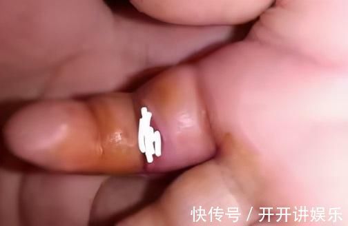 美容|孩子误吞硬币、意外受伤该怎么办?儿科医生提醒:这样做才正确