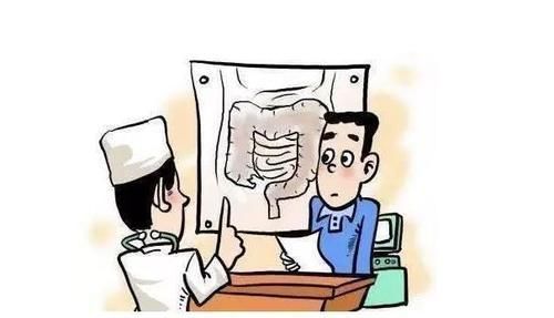 间歇性|身体出现这4个表现,可能是肠癌所引起的,还请及时去医院排查!