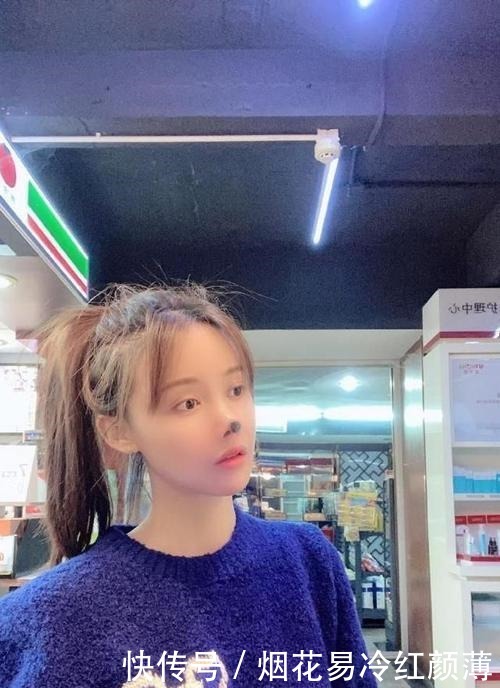 生涯|演员高溜整容失败致鼻子坏死,演绎生涯或就此结束