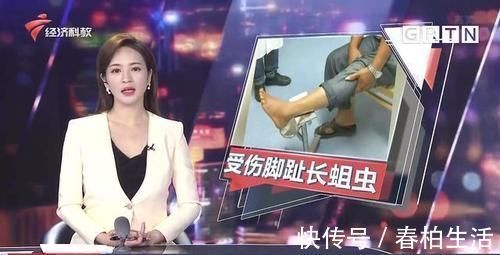 莫伯|男子脚趾受伤后竟爬出蛆虫 需做截肢手术 病情为何如此严重？