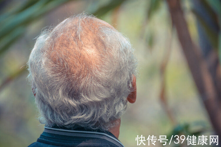头发|为什么白头发会越长越多？不一定是老了，可能与缺乏4种营养有关