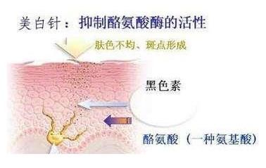 女生|靠“美白针”而“逆袭”的女生，如今的肤色如何？网友：难以相信