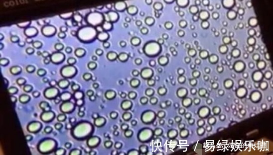 宝妈|“母乳”放大1000倍什么样?显微镜下会动,网友:世间最纯净东西