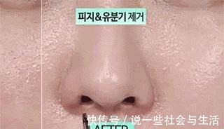 黑头 毛孔粗大难改善4种毛孔问题对症下药|医美科普!