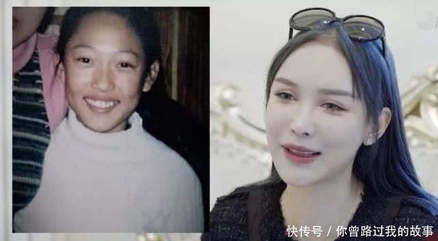 整容手术|14岁时,我接受了母亲的治疗,我花了400万美元进行整形手术!