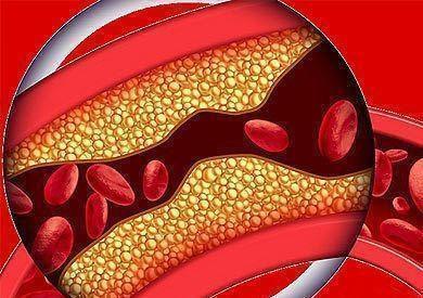 气球|血压180/110,却未见任何“异常”症状,如果不管会有什么后果?