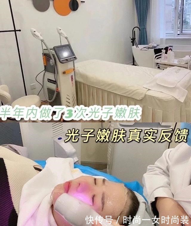 医美 半年内做了3次光子嫩肤，光子嫩肤真实反馈！