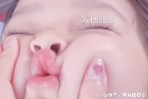 恶习|女生想要“樱桃小嘴”?赶紧戒掉3恶习,小心“香肠嘴”没人喜欢!