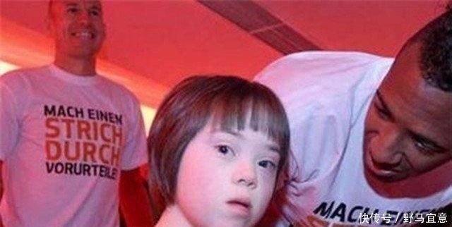 孕妈们|爱与痛的边缘,避免生出“唐氏儿”,引起原因孕妈需知道