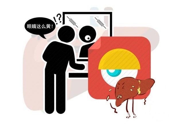 胰腺癌|眼睛是癌细胞的“感应器”，眼睛若出现3种异常，尽快排查癌症