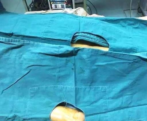 手术|为什么做手术时，医生会要求患者脱光衣服？护士偷偷道出实情