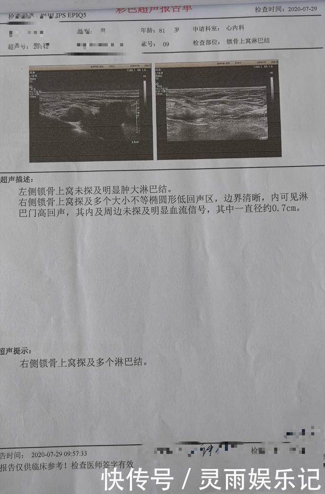 肝癌早期,身体这6处会亮“红灯”!希望你早点抓住