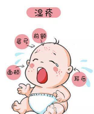 晒伤|夏季家长如何给宝宝护肤,正确护理可以让宝宝远离皮肤问题