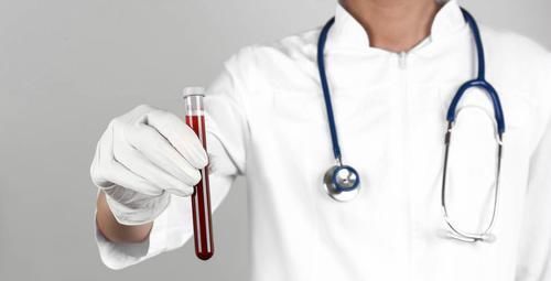 老高|前列腺有癌,小便先知,排尿若出现三个特征,最好去检查PSA