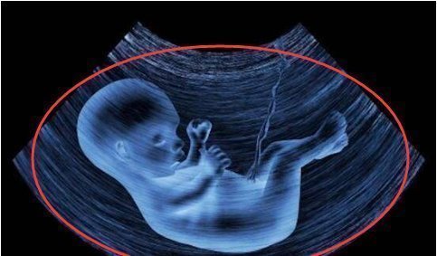 子宫内|孕24周B超检查，当看到宝宝的样子后，孕妈有些吓到了