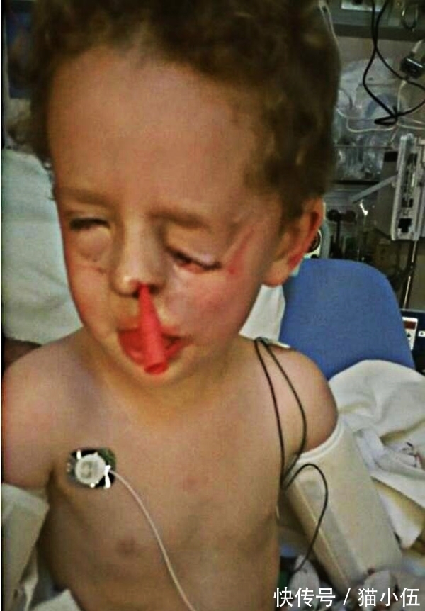 眼睛|小男孩出生时父母吓一跳,眼睛竟然长在脸上,长大后了不起!