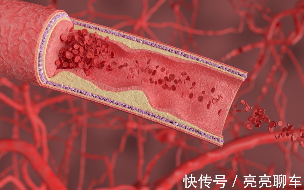 老年人|多走路有助于长寿?其实,人过了50岁,做好4件事,或比走路有效