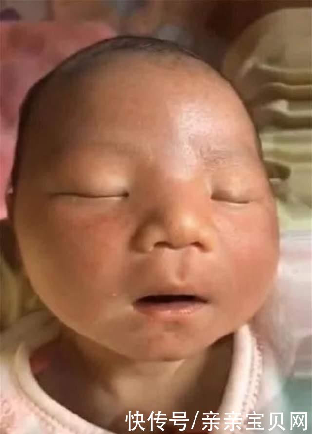 宝妈|宝妈生下“黑脸宝宝”，家人纷纷嫌弃丑，2个月后宝宝完美逆袭