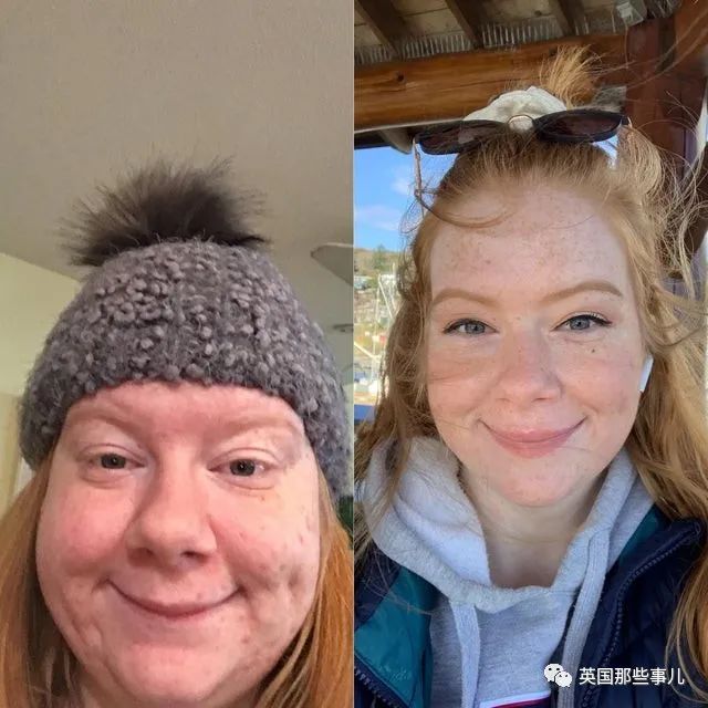 精气神|一个姑娘减掉230斤是什么样子…对比照惊到我了