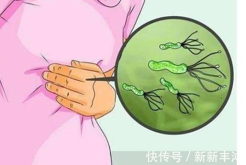 胃息肉|饭后出现这4个表现,可能是胃部出现问题了,别等得胃癌了才后悔!