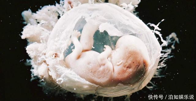 羊膜|现实版“哪吒”,产妇生下“带壳”宝宝想遗弃,医生却说恭喜你