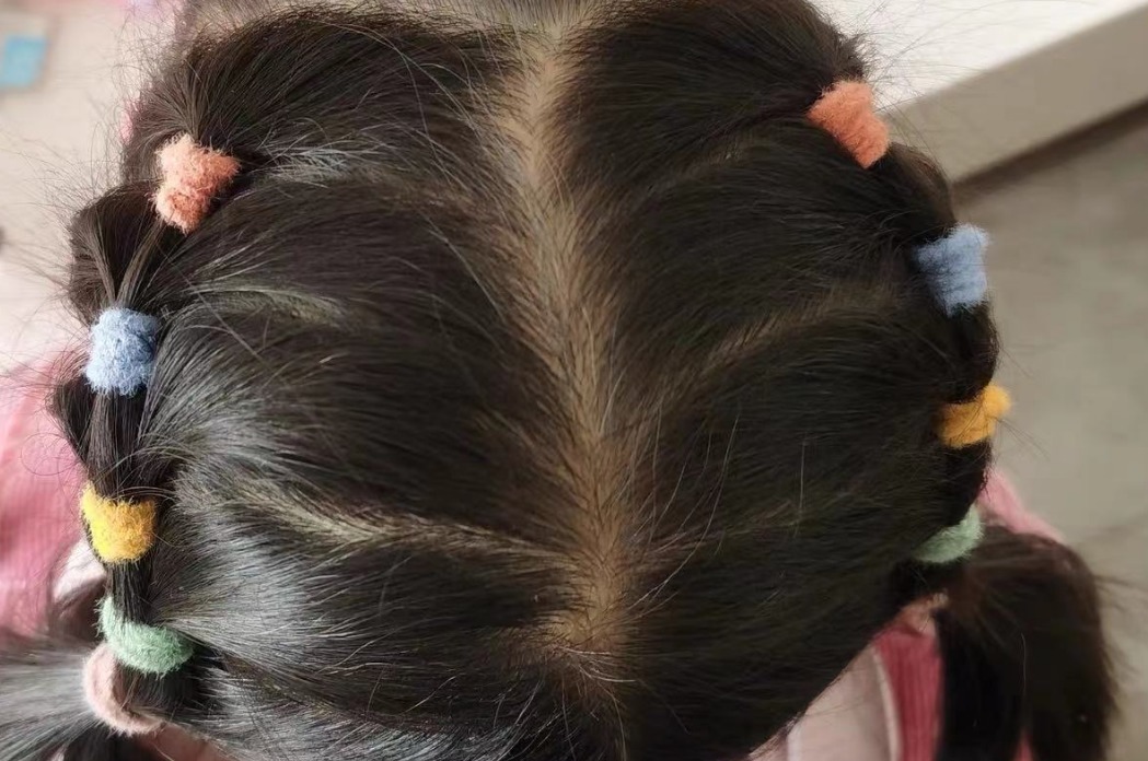 幼儿园老师|看到幼儿园老师给孩子扎的头发,宝妈心疼极了,怒斥太不负责了