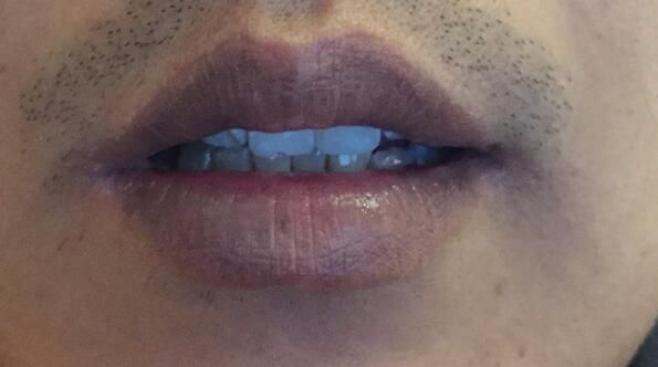 健康|身体健康不健康，通过嘴唇颜色可以判断