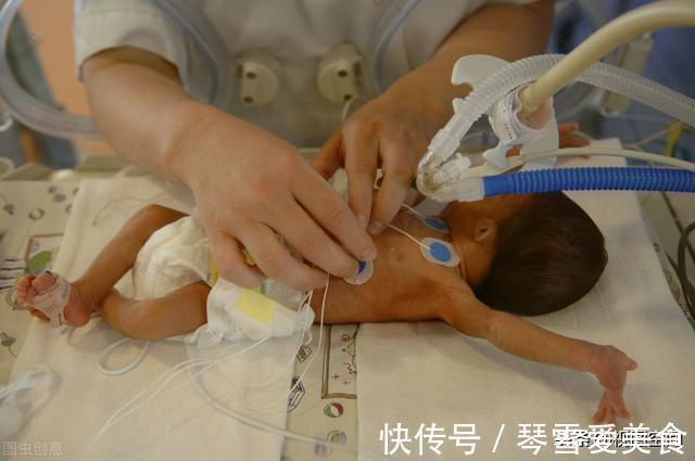 巴掌宝宝|桂林“巴掌宝宝”出生时仅600克,97天后创“生命奇迹”