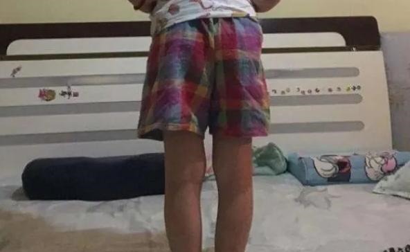 指标|孩子这三个部位“短”,将来可能不会高,希望你的孩子一个都没中