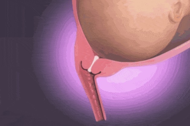 顺产|顺产到底有多疼,给你们看完这18图片,就能真正理解女人不容易