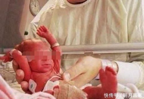俩人|孩子出生吓得护士都不敢抱!原因竟是因为女子流产多次!