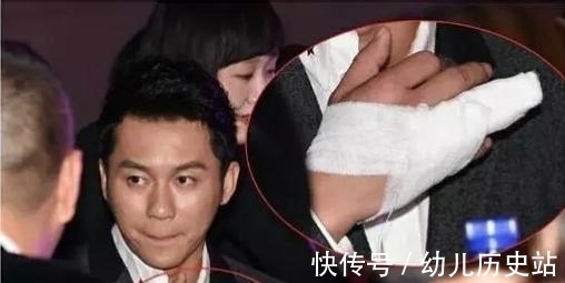 李晨：錄制節(jié)目時(shí)候非常努力，然而他經(jīng)常因?yàn)橐恍﹤€(gè)人問題而受傷